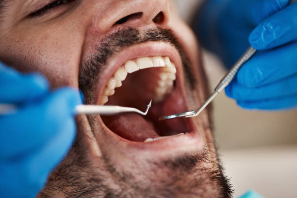 Best Broken or Cracked Tooth Emergency Dentist in Newport East, RI