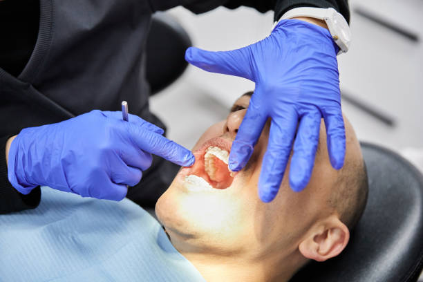 Best Emergency Root Canal Treatment in Newport East, RI