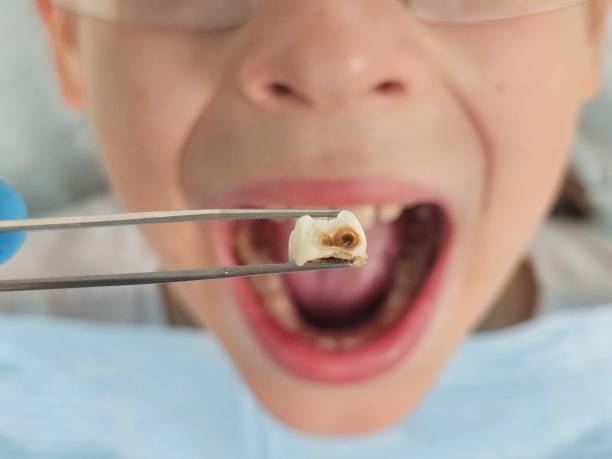 Best Urgent Dental Care for Toothache in Newport East, RI